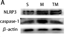 NLRP3 Antibody - Figure 3.