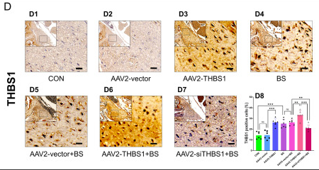THBS1 Antibody - Fig.