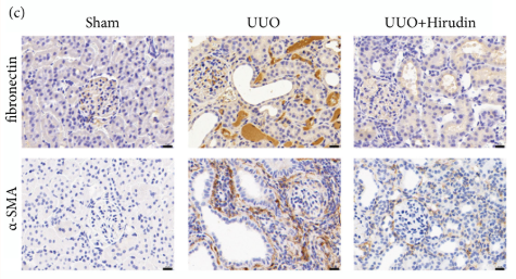 alpha-SMA Antibody - Figure 1 Effect of hirudin on renal injury and renal fibrosis in UUO rats.