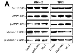 Phospho-AMPK alpha (Thr172) Antibody - Fig.