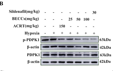 Phospho-PDPK1 (Ser241) Antibody - Figure 5.