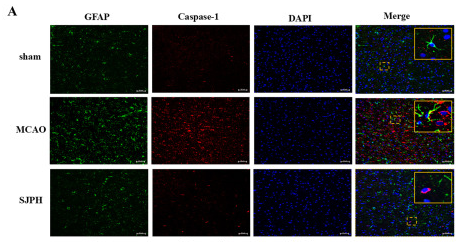 Factor VIII Antibody - Fig.