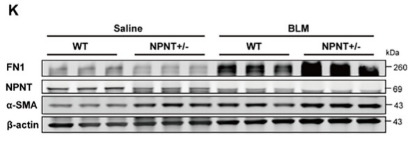 alpha-SMA Antibody - Figure 2 NPNT deficiency exacerbated BLM-induced pulmonary fibrosis and pulmonary dysfunction in mice.