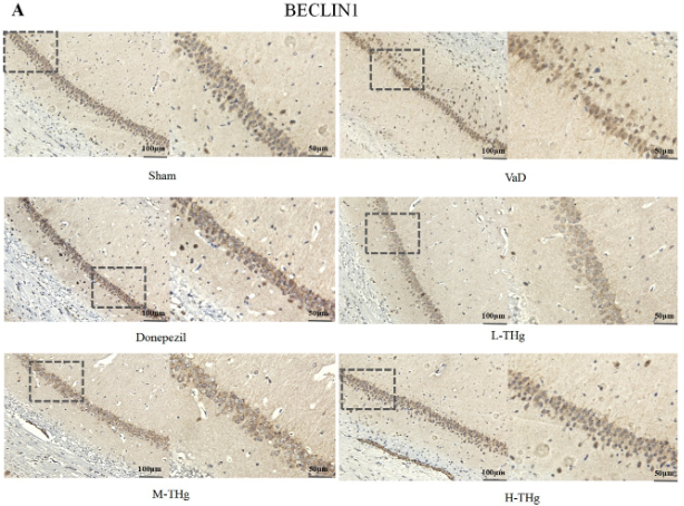Beclin 1 Antibody - Figure 8.