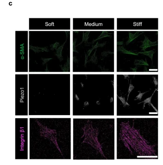 Piezo1 Antibody - Fig.