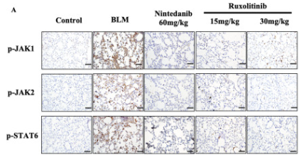 Phospho-JAK1 (Tyr1022)[Tyr1034] Antibody - Fig.