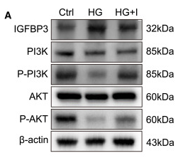 beta Actin Antibody - Figure 6 ICA alleviates oxidative stress and apoptosis in diabetic SD rats (A) Immunoblot analysis of the indicated proteins in the lens of SD rats in Ctrl, HG, and HG + I groups; 3 lenses were surgically harvested and pooled to extract protein for immunoblot assay.