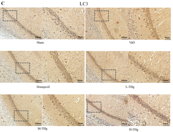 LC3A/B Antibody - Figure 8.