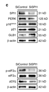 Phospho-eIF2 alpha (Ser51)[Ser52] Antibody - Fig.