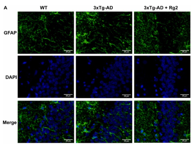 GFAP Antibody - Fig.
