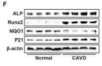 NQO1 Antibody - Figure 1 Cellular senescence is associated with aortic valve calcification.