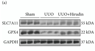 xCT Antibody - Figure 2 Effect of hirudin on ferroptosis and STAT3/NLRP3 pathway in UUO rats.