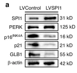 GLB1 Antibody - Fig.