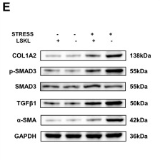 Phospho-Smad3 (Ser425) Antibody - Fig.