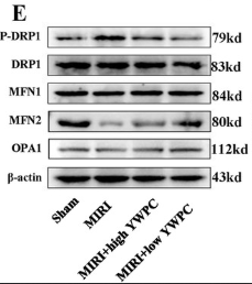 Phospho-DRP1 (Ser616) Antibody - Figure 3.