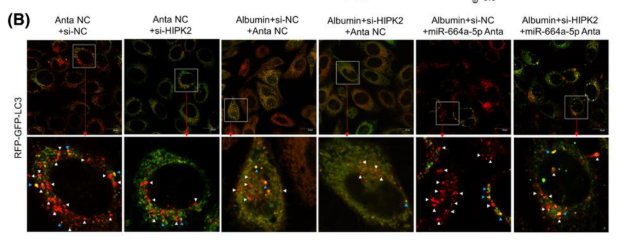 LC3A/B Antibody - FIGURE 3 Effects of miR-664a-5p/HIPK2/Calpain1/GSα signal pathway-mediated autophagy inhibition in HK-2 cells injury caused by albumin.