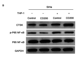 CTSK Antibody - Fig.