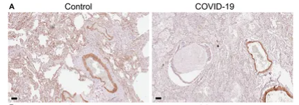 CDH13 Antibody - Figure 1.