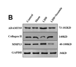 ADAMTS5 Antibody - Figure 6.