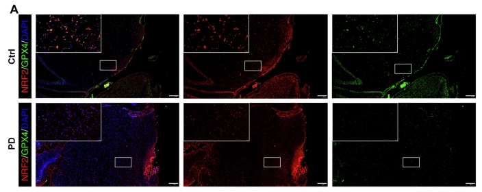 Nrf2 mouse monoclonal Antibody - Fig.