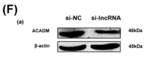 ACADM Antibody - Fig.