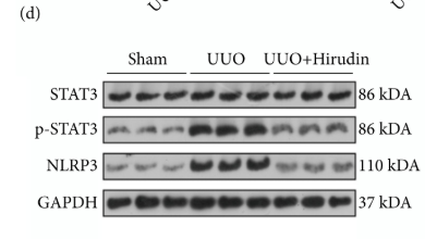 Phospho-STAT3 (Tyr705) Antibody - Figure 2 Effect of hirudin on ferroptosis and STAT3/NLRP3 pathway in UUO rats.