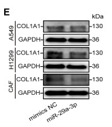 Collagen I Antibody - Figure 4 Identification of COL1A1 as target of miR-29a-3p (A) The target genes of miR-29a-3p were predicted using the TargetScan 7.