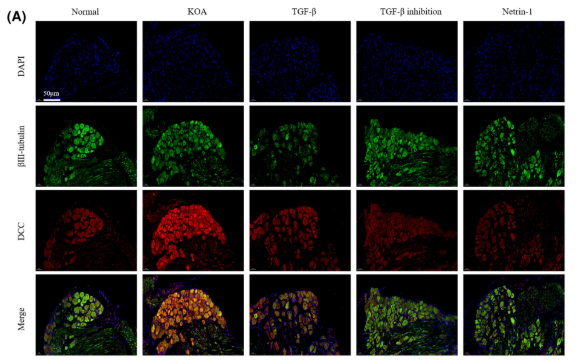 DCC Antibody - FIGURE 2 KOA synovial fibrosis initiates Netrin-1 induction of sensory nerve germination.