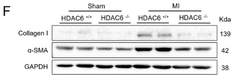 alpha-SMA Antibody - FIGURE 1 Increased expression of HDAC6 in the left atrial (LA) post-myocardial infarction (MI) contributes to atrial fibrosis and enlargement, and this is alleviated by HDAC6 deficiency.