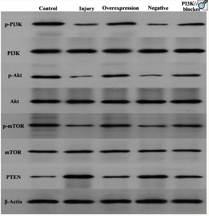 Phospho-AKT1/2/3 (Ser473) Antibody - Figure 3.