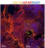 GFAP Antibody - Fig.