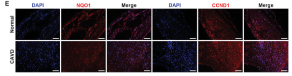 Cyclin D1 Antibody - Figure 1 Cellular senescence is associated with aortic valve calcification.