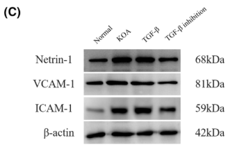 Netrin-1 Antibody - FIGURE 1 KOA synovial fibrosis activates vascular endothelial cells to promote Netrin-1 secretion.