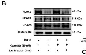 HDAC4 Antibody - Figure 4.