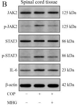 JAK2 Antibody - Figure 5.