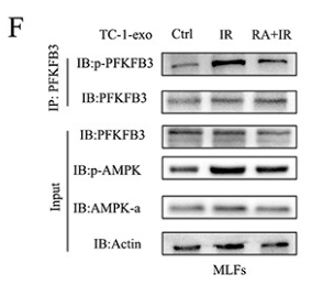 Phospho-AMPK alpha (Thr172) Antibody - Figure 7 RA diminished glycolysis by reducing acetylated PFKFB3 and cytoplasmic translocation.