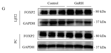 FOXP2 Antibody - Fig.