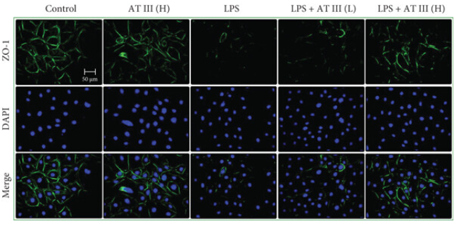ZO 1 Antibody - Figures 5.