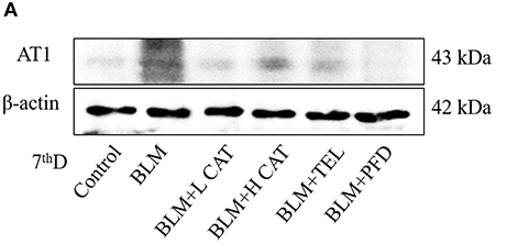 beta Actin Antibody - Figure 3.