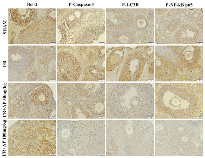Phospho-NF-kB p65 (Ser536) Antibody - FIGURE 5 Bcl-2, P-Caspase-3, P-LC3B, P-NF-kB p65 antibody immunoreactivities of all groups.