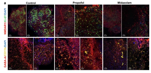 NMDAR1 Antibody - Fig.