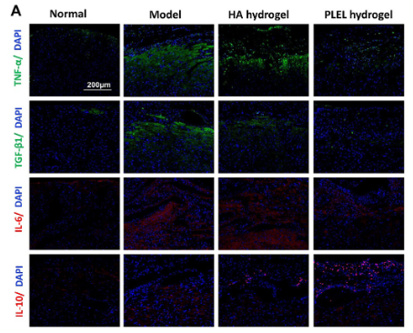 TNF alpha Antibody - Figure 7 Effects of the PLEL hydrogel on the inflammatory response in a rat model of cardiac injury adhesion.