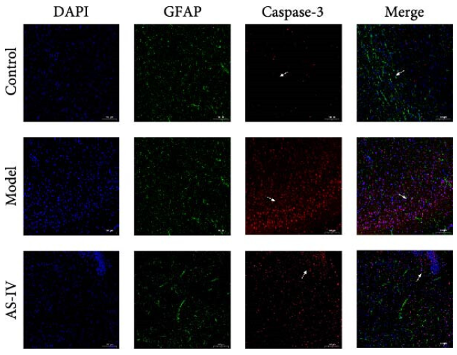 GFAP Antibody - Figure 6 (b) Immunofluorescence was employed to detect protein expression in rat brain tissue, followed by statistical analysis: (a) brain sections treated with DAPI (blue), PCNA (red), TH (green), Tuj-1 (orange), 7 and 14 days after AS-IV intervention, observed under a 10x microscope (scale bar = 100 μm); (b) staining of the brain sections with DAPI (blue), GFAP (green), caspase-3 (red) (scale bar = 100 μm), arrows represent caspase-3 protein fluorescence; (c) statistical comparison of fluorescence intensities of PCNA by the independent samples t test for PCNA; (d) fluorescence intensity of TH by independent samples t test; (e) fluorescence intensity of PCNA by independent samples t test; (f) fluorescence intensity of caspase-3 by independent samples t test; the data are expressed as mean ± SEM; n ≥ 3, ( ∗P < 0.