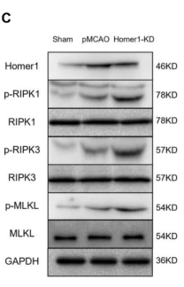 Phospho-RIPK1 (Ser166) Antibody - Fig.