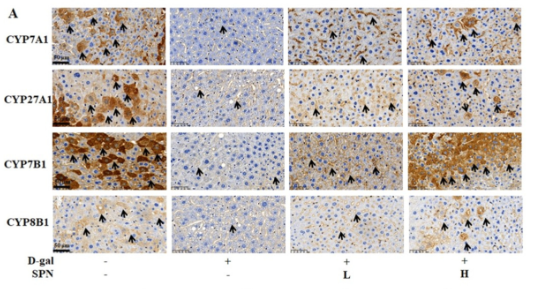 Cytochrome P450 27A1 Antibody - Figure 4.