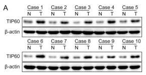 beta Actin Antibody - Fig.