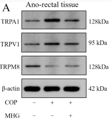 TRPV1 Antibody - Figure 4.