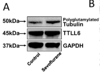 TTLL6 Antibody - FIGURE 3 Effects of repeated sevoflurane exposure on Tau and TTLL6 missorting in hippocampus of neonatal mice.