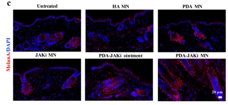 MLANA Antibody - Fig.