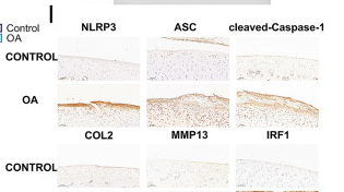 Cleaved-Caspase 1 (Asp296), p20 Antibody - Fig.